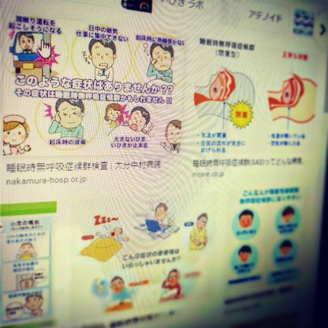 睡眠時無呼吸症候群悪化？